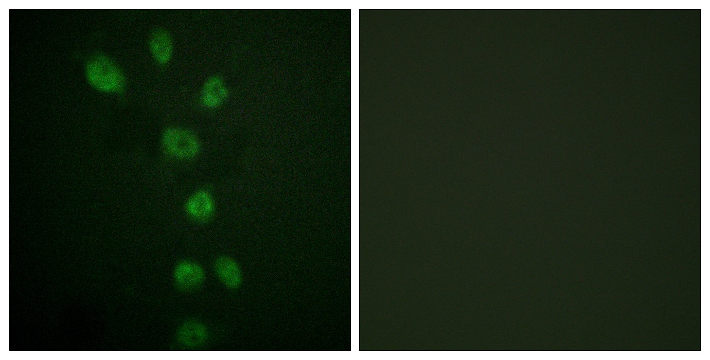  Immunofluorescence analysis of HepG2 cells, using GATA4 (Phospho-Ser105) Antibody. The picture on the right is blocked with the phospho peptide.