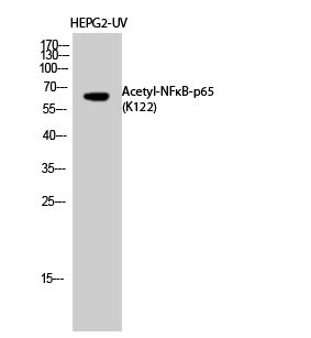  Western Blot analysis of HEPG2-UV cells using Acetyl-NFκB-p65 (K122) Polyclonal Antibody diluted at 1：1000. Secondary antibody(catalog#：RS0002) was diluted at 1:20000