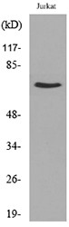  Western blot analysis of lysate from Jurkat cells, using NFκB-p65 (Acetyl-Lys218) Antibody.