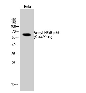  Western Blot analysis of Hela cells using Acetyl-NFκB-p65 (K314/K315) Polyclonal Antibody. Secondary antibody(catalog#：RS0002) was diluted at 1:20000