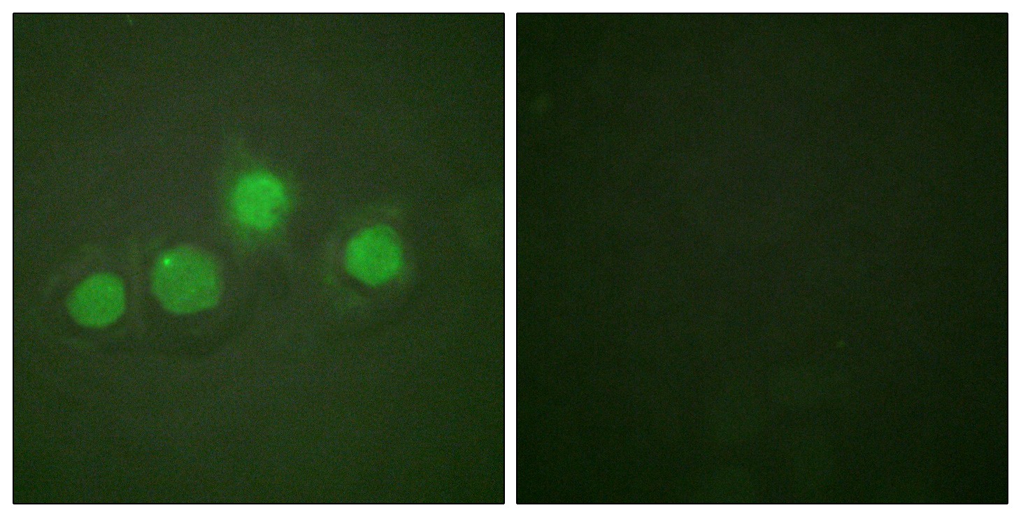  Immunofluorescence analysis of HUVEC cells, using GATA4 (Phospho-Ser262) Antibody. The picture on the right is blocked with the phospho peptide.