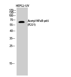  Western Blot analysis of HEPG2-UV cells using Acetyl-NFκB-p65 (K221) Polyclonal Antibody diluted at 1：1000. Secondary antibody(catalog#：RS0002) was diluted at 1:20000