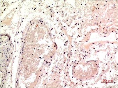 Gamma Tubulin Mouse Monoclonal Antibody(7C1)