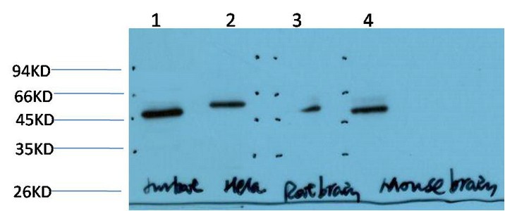  Western Blot analysis of paraffin-embedded Jurkat\Hela\Mouse-brain\Rat-brain using Gamma Tubulin Mouse mAb diluted at 1:1000.