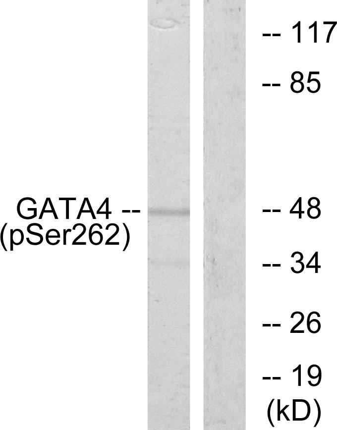  Western blot analysis of lysates from 293 cells, using GATA4 (Phospho-Ser262) Antibody. The lane on the right is blocked with the phospho peptide.