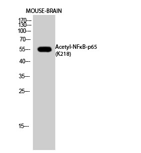  Western Blot analysis of MOUSE-BRAIN cells using Acetyl-NFκB-p65 (K218) Polyclonal Antibody diluted at 1：1000. Secondary antibody(catalog#：RS0002) was diluted at 1:20000