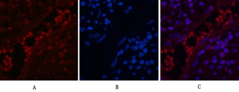  Immunofluorescence analysis of Human-appendix tissue. 1,NFκB-p65 (Acetyl Lys310) Polyclonal Antibody(red) was diluted at 1:200(4°C,overnight). 2, Cy3 labled Secondary antibody was diluted at 1:300(room temperature, 50min).3, Picture B: DAPI(blue) 10min. Picture A:Target. Picture B: DAPI. Picture C: merge of A+B