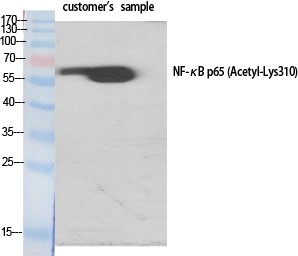  Western Blot analysis of various cells using Acetyl-NFκB-p65 (K310) Polyclonal Antibody diluted at 1：1000. Secondary antibody(catalog#：RS0002) was diluted at 1:20000