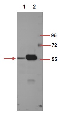  The picture was kindly provided by our customer,antibody was diluted at 1:500