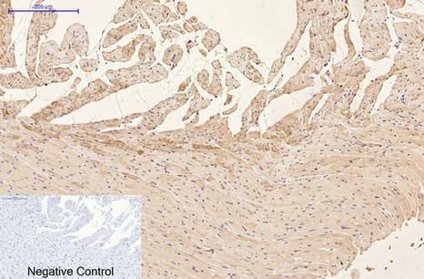  Immunohistochemical analysis of paraffin-embedded Mouse-kidney tissue. 1,GFAP Monoclonal Antibody(5C8) was diluted at 1:200(4°C,overnight). 2, Sodium citrate pH 6.0 was used for antibody retrieval(>98°C,20min). 3,Secondary antibody was diluted at 1:200(room tempeRature, 30min). Negative control was used by secondary antibody only.