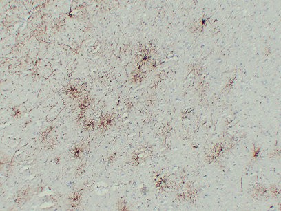  Immunohistochemical analysis of paraffin-embedded Brain. 1, Antibody was diluted at 1:200(4°,overnight). 2, Tris-EDTA,pH8.0 was used for antigen retrieval. 3,Secondary antibody was diluted at 1:200(room temperature, 30min).