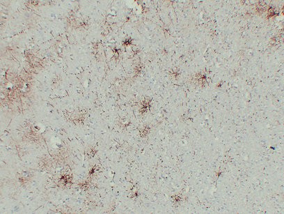 Immunohistochemical analysis of paraffin-embedded Brain. 1, Antibody was diluted at 1:200(4°,overnight). 2, Tris-EDTA,pH8.0 was used for antigen retrieval. 3,Secondary antibody was diluted at 1:200(room temperature, 30min).