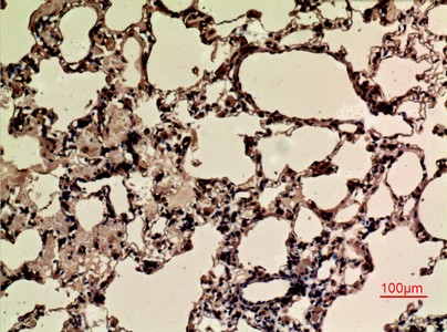  Immunohistochemical analysis of paraffin-embedded rat-lung, antibody was diluted at 1:100