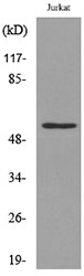  Western blot analysis of lysate from Jurkat cells, using p53 (Acetyl-Lys372) Antibody.