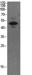p53 (Acetyl Lys373) Polyclonal Antibody