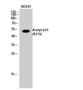  Western Blot analysis of AD293 cells using Acetyl-p53 (K370) Polyclonal Antibody diluted at 1：1000. Secondary antibody(catalog#：RS0002) was diluted at 1:20000