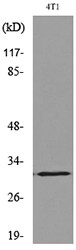 Western blot analysis of lysate from 4T1 cells, using p57Kip2 (Acetyl-Lys278) Antibody.