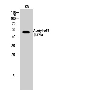  Western Blot analysis of KB cells using Acetyl-p53 (K373) Polyclonal Antibody. Secondary antibody(catalog#：RS0002) was diluted at 1:20000