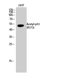  Western Blot analysis of 293T cells using Acetyl-p53 (K372) Polyclonal Antibody diluted at 1：2000. Secondary antibody(catalog#：RS0002) was diluted at 1:20000
