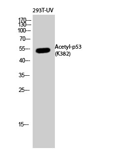  Western Blot analysis of 293T-UV cells using Acetyl-p53 (K382) Polyclonal Antibody diluted at 1：500. Secondary antibody(catalog#：RS0002) was diluted at 1:20000