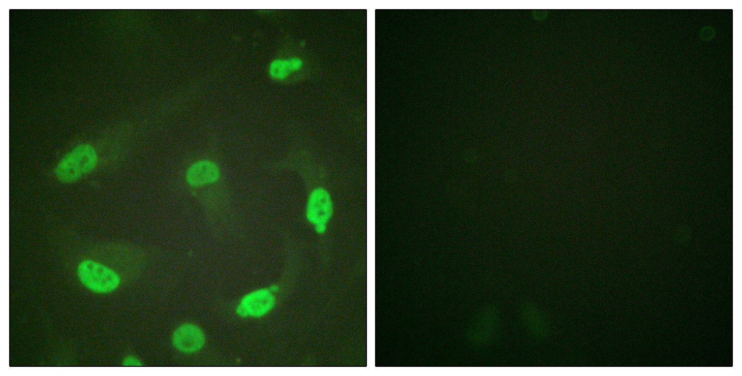  Immunofluorescence analysis of HeLa cells, using p53 (Acetyl-Lys379) Antibody. The picture on the right is blocked with the synthesized peptide.
