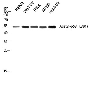 p53 (Acetyl Lys381) Polyclonal Antibody