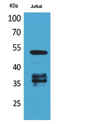 p53 (Acetyl Lys370) Polyclonal Antibody