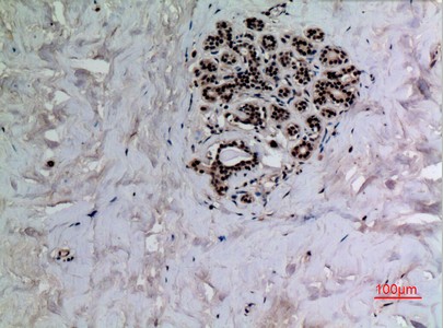  Immunohistochemical analysis of paraffin-embedded human-breast, antibody was diluted at 1:100