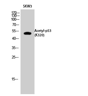  Western Blot analysis of SKW3 cells using Acetyl-p53 (K320) Polyclonal Antibody. Secondary antibody(catalog#：RS0002) was diluted at 1:20000