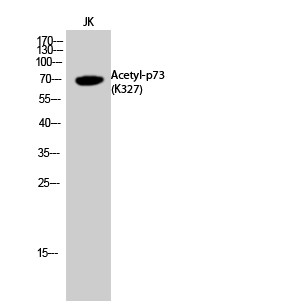  Western Blot analysis of JK cells using Acetyl-p73 (K327) Polyclonal Antibody. Secondary antibody(catalog#：RS0002) was diluted at 1:20000
