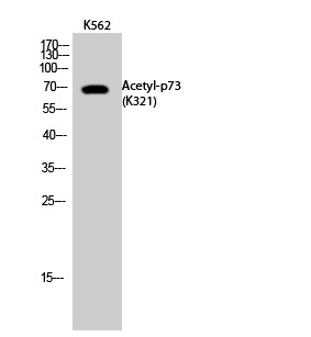  Western Blot analysis of K562 cells using Acetyl-p73 (K321) Polyclonal Antibody. Secondary antibody(catalog#：RS0002) was diluted at 1:20000