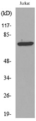  Western blot analysis of lysate from Jurkat cells, using p73 (Acetyl-Lys327) Antibody.