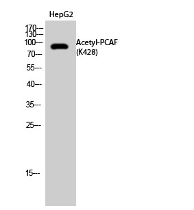  Western Blot analysis of HepG2 cells using Acetyl-PCAF (K428) Polyclonal Antibody. Secondary antibody(catalog#：RS0002) was diluted at 1:20000
