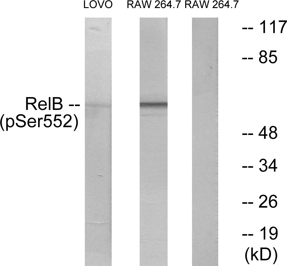  Western blot analysis of lysates from LOVO cells and RAW264.7 cells, using RelB (Phospho-Ser552) Antibody. The lane on the right is blocked with the phospho peptide.