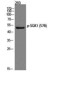 SGK1 (phospho Ser78) Polyclonal Antibody