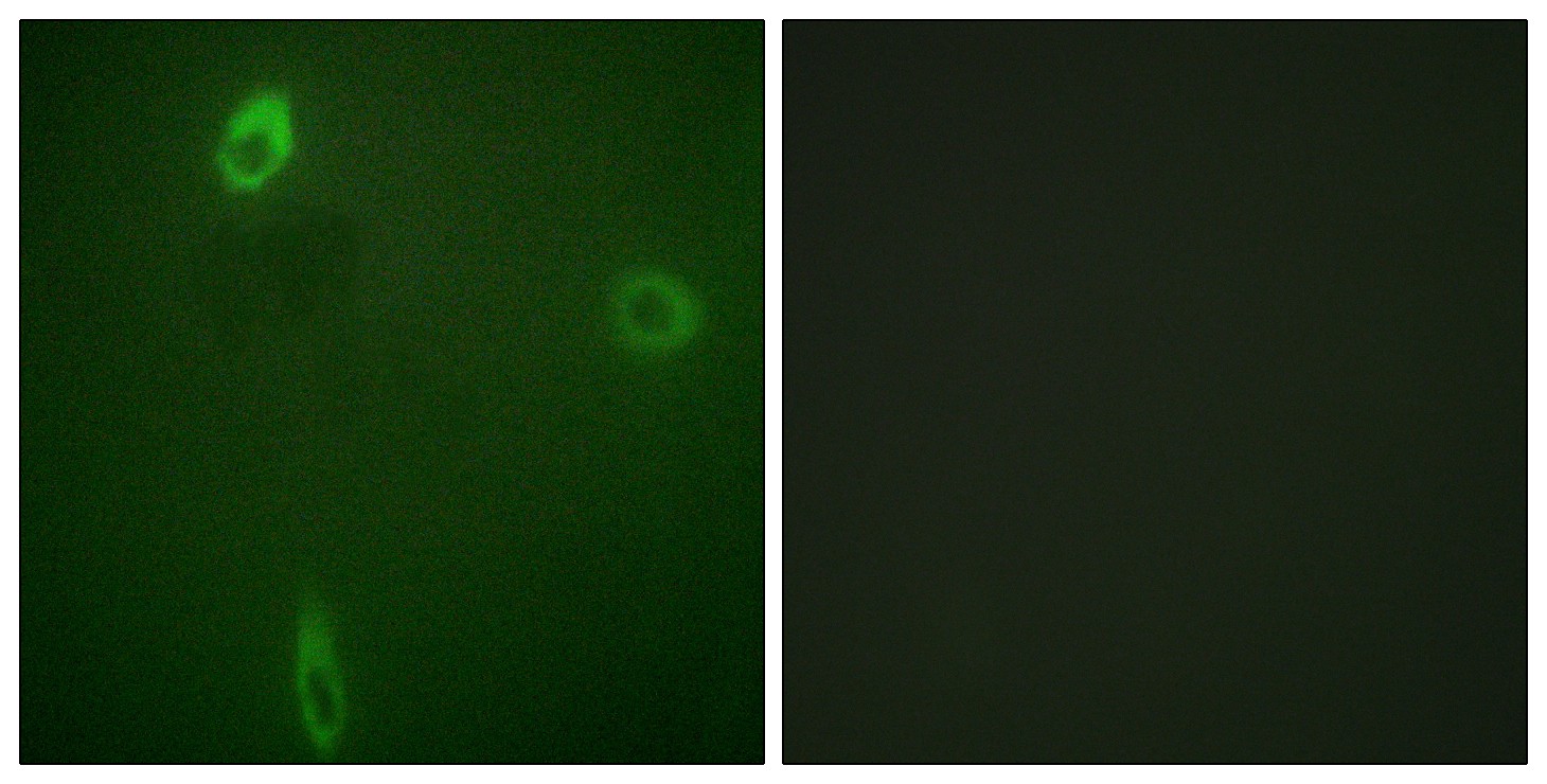  Immunofluorescence analysis of A549 cells, using ROMK/Kir1.1 (Phospho-Ser44/25) Antibody. The picture on the right is blocked with the phospho peptide.