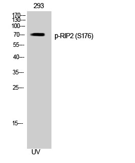 RIP2 (phospho Ser176) Polyclonal Antibody