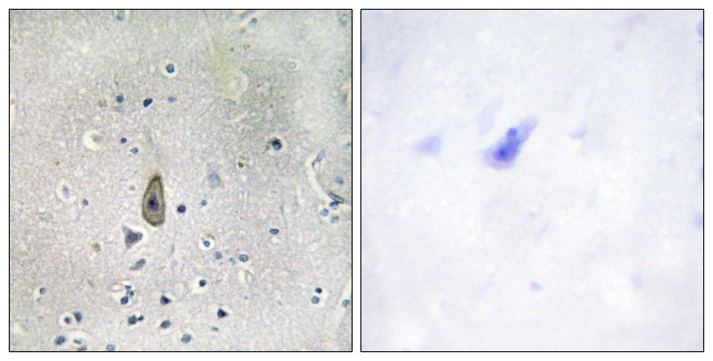  Immunohistochemistry analysis of paraffin-embedded human brain, using ROMK/Kir1.1 (Phospho-Ser44/25) Antibody. The picture on the right is blocked with the phospho peptide.