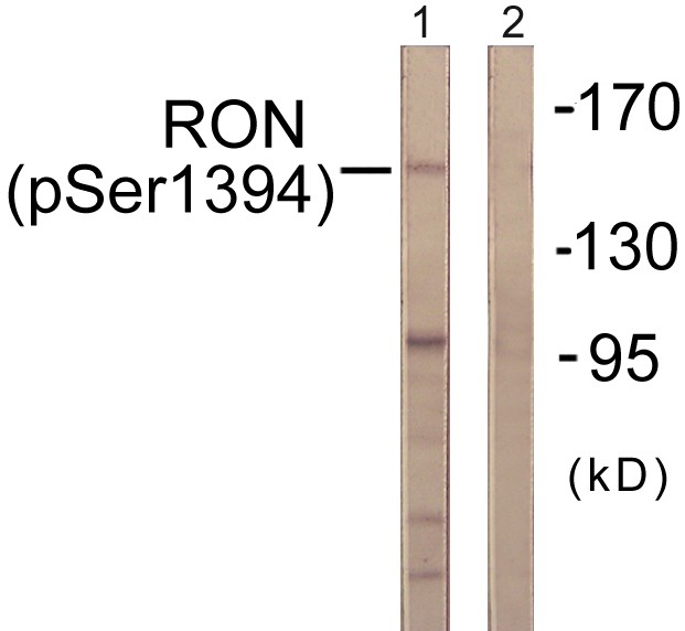  Western blot analysis of lysates from HeLa cells treated with TNF-a 20ng/ml 2', using CD136/RON (Phospho-Ser1394) Antibody. The lane on the right is blocked with the phospho peptide.