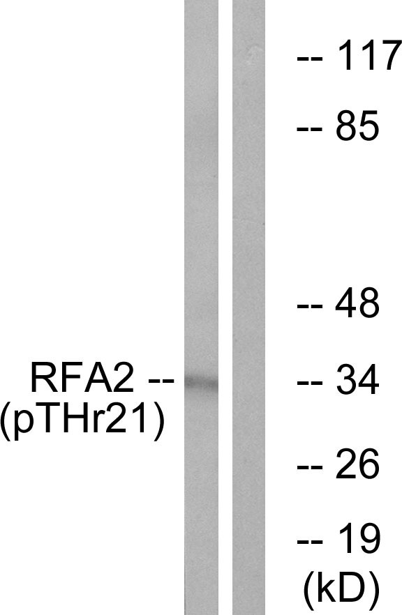  Western blot analysis of lysates from HeLa cells treated with Adriamycin 0.5ug/ml 24h, using RFA2 (Phospho-Thr21) Antibody. The lane on the right is blocked with the phospho peptide.