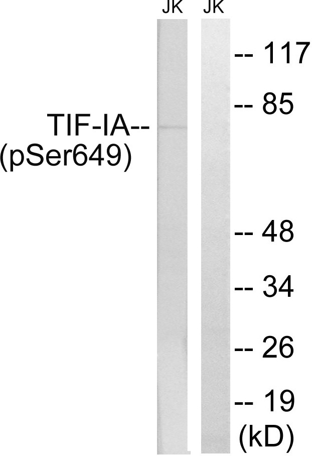  Western blot analysis of lysates from Jurkat cells treated with starved 24h, using TIF-IA (Phospho-Ser649) Antibody. The lane on the right is blocked with the phospho peptide.