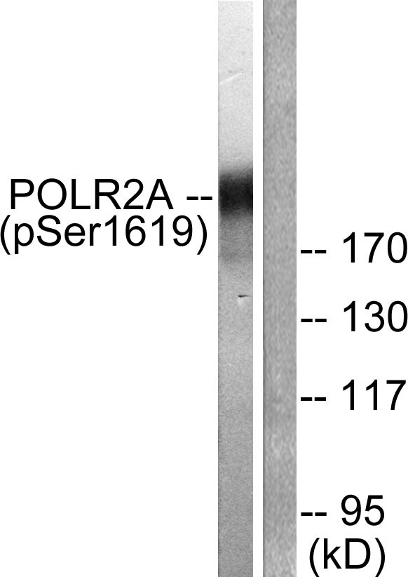  Western blot analysis of lysates from COS7 cells treated with EGF 200ng/ml 30', using POLR2A (Phospho-Ser1619) Antibody. The lane on the right is blocked with the phospho peptide.
