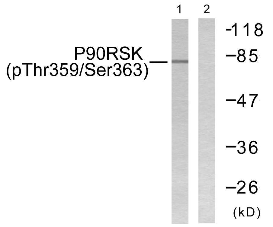  Western blot analysis of lysates from 293 cells treated with PMA 125ng/ml 30', using p90 RSK (Phospho-Thr359+Ser363) Antibody. The lane on the right is blocked with the phospho peptide.