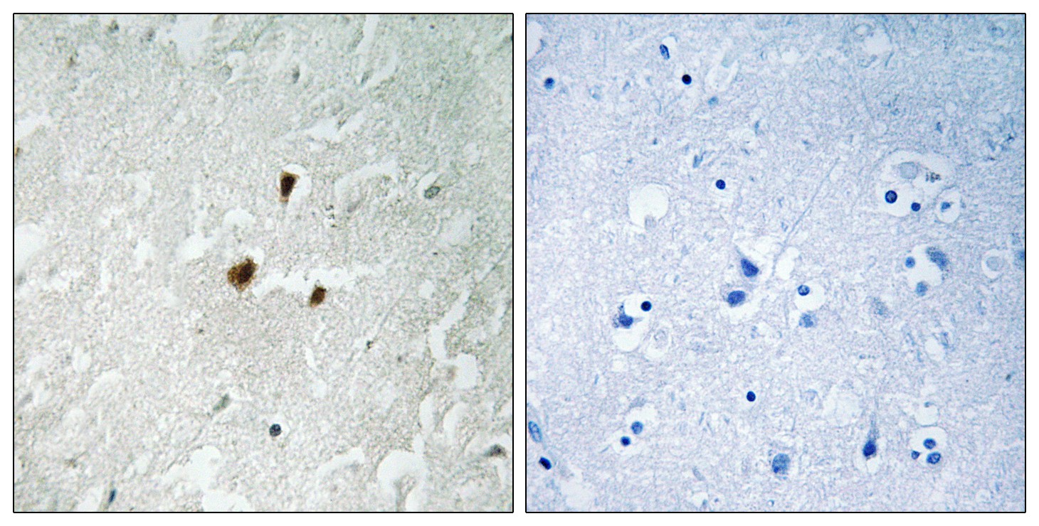  Immunohistochemistry analysis of paraffin-embedded human brain, using TIF-IA (Phospho-Ser649) Antibody. The picture on the right is blocked with the phospho peptide.