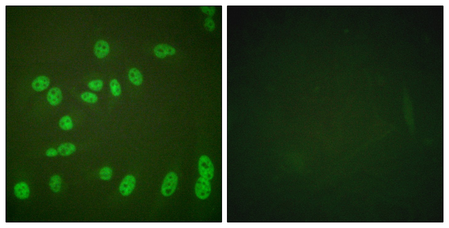  Immunofluorescence analysis of HeLa cells treated with PMA 125ng/ml 30', using POLR2A (Phospho-Ser1619) Antibody. The picture on the right is blocked with the phospho peptide.