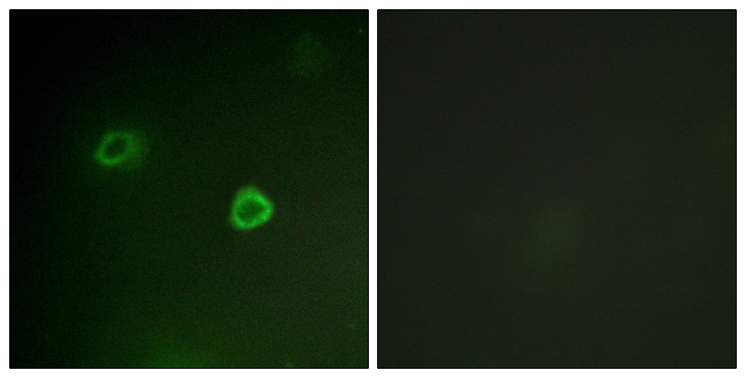  Immunofluorescence analysis of COS7 cells, using p90 RSK (Phospho-Thr573) Antibody. The picture on the right is blocked with the phospho peptide.