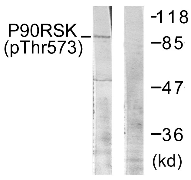  Western blot analysis of lysates from 293 cells treated with UV 30', using p90 RSK (Phospho-Thr573) Antibody. The lane on the right is blocked with the phospho peptide.