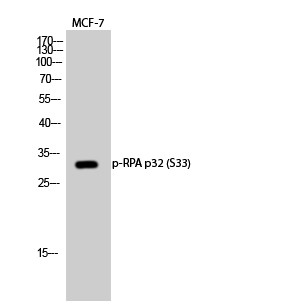  Western Blot analysis of MCF-7 cells using Phospho-RPA p32 (S33) Polyclonal Antibody diluted at 1：500 cells nucleus extracted by Minute TM Cytoplasmic and Nuclear Fractionation kit (SC-003,Inventbiotech,MN,USA).