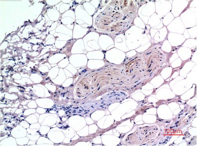 Smad3 Mouse Monoclonal Antibody(4C9)