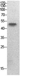  Western Blot analysis of HepG2 cells using Acetyl-PTEN (K402) Polyclonal Antibody.. Secondary antibody(catalog#：RS0002) was diluted at 1:20000